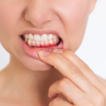 Dental Health Myths Debunked