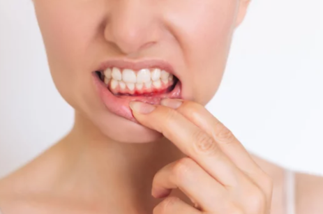 Dental Health Myths Debunked