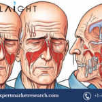 giant cell arteritis treatment market