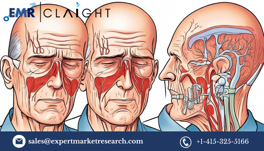 giant cell arteritis treatment market