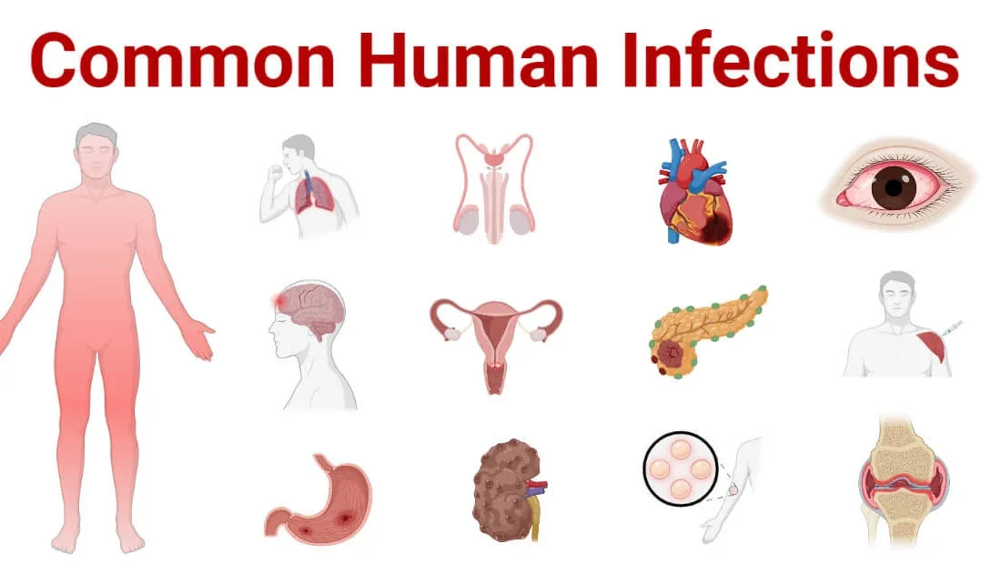 What is the most serious type of infection?