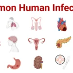 What is the most serious type of infection?