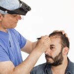 تكلفة زراعة الشعر في دبي