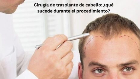 Transplante de cabello